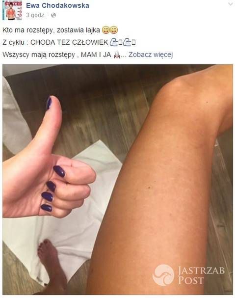 Ewa Chodakowska ma rozstępy