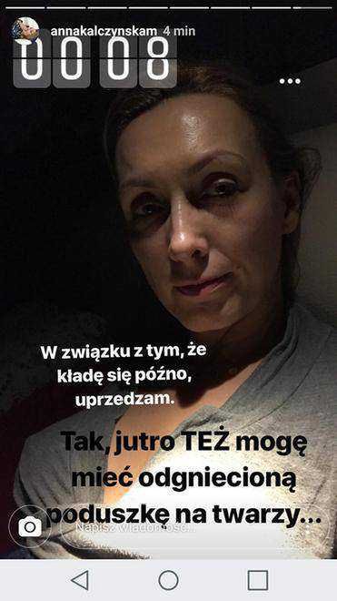 Anna Kalczyńska bez maikijażu